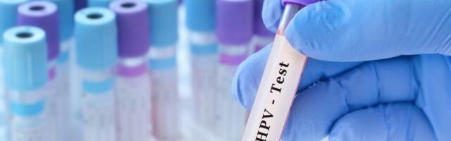 Svaka osma žena u Srbiji ima HPV: Stručnjaci upozoravaju na značaj pregleda