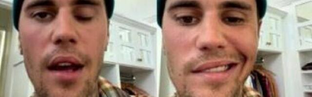 Biberu bolest paralisala pola lica, a mogao bi i da ogluvi