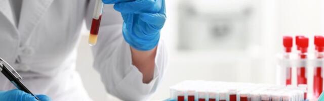 Šta je ovo u BiH?! Izvadili ljudima krv pa se zaledili: Analize potvrdile užas, vlasti ćute