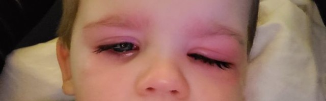 “Moj sin je prsnuo vodu u oko iz gumene igračke za kupanje. Ubrzo je počeo pakao, zamalo je oslepeo"