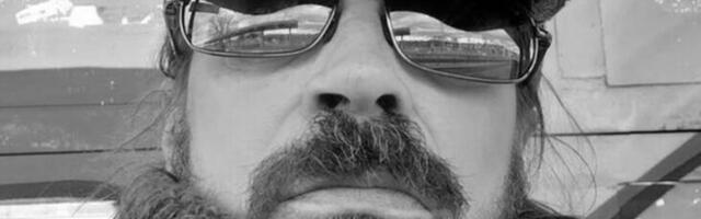 ZBOG ZRAČENJA MU OSTALA ZADEBLJANJA I OTEKLINE! Imao rak glave i vrata, pa zbog bolesti spao na 35 kila