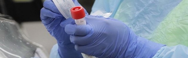 Odbijene privatne laboratorije koje su tražile da rade PCR testove