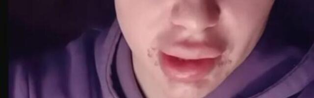 POSLE ANE NIKOLIĆ, I NJEMU LICE ZAVRŠILO U KRASTAMA! Ljudi zgroženi prizorom, UZROK je ovo?