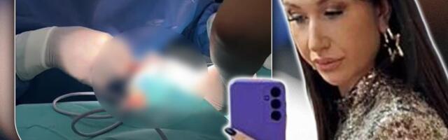 "APELUJEM NA SVE MLADE DEVOJKE DA NE NAPRAVE ISTU GREŠKU KAO JA..." Nataša Alimpić završila na operacionom stolu, pevačica izvadila silikone iz usana (FOTO)