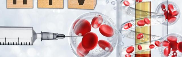 OGLASILO SE MINISTARSTVO: Broj HIV infekcija u Rusiji prepolovljen u poslednjih 10 godina