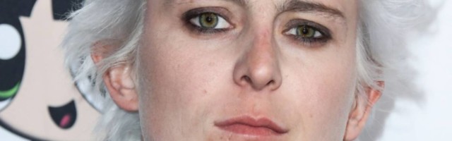 Naslednik Geti bogatstva promenio pol i pokazao ožiljke na grudima posle operacije
