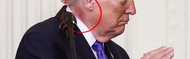 ŠTA JE TO NA VRATU DONALDA TRAMPA? U jeku sukoba sa Iranom pojavio se sa OGROMNOM RANOM? (FOTO)