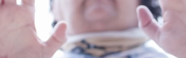 Više od 150. operacija, posle dve godine, mladić se konačno može osmehnuti!