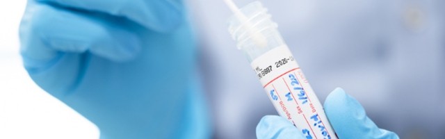 Više od 300 novozaraženih, preminulo četvoro