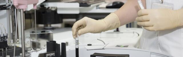 Višak masnog tkiva i smanjena mišićna masa dokazano vrlo opasni po zdravlje