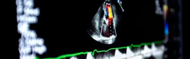 Nova tehnologija može postati prvi lek za srčani udar na svetu