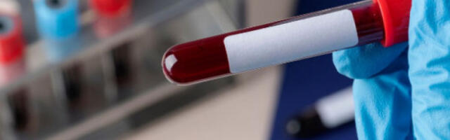 Кнежевићева: У Институту највише недостају Б и нулта негативна крвна група