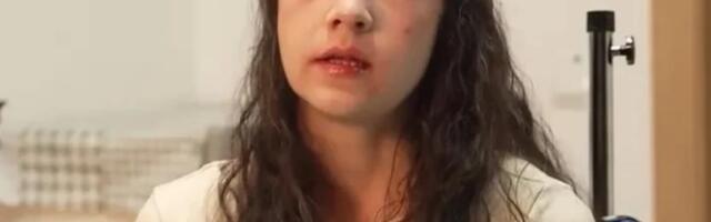 Reči oca devojke koja je otišla na eutanaziju kidaju dušu: Poslednji snimak otkrio šta se dešavalo, najbolja prijateljica jurila do bolnice da je zaustavi