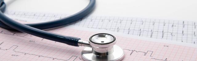 Šta je EKG i šta pokazuje?