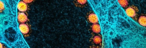 Otkriven novi rod najbliži SARS-CoV-2 virusu i nalazi se u slepim miševima