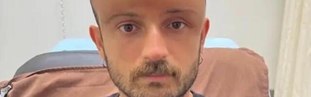 Zbog uživanja na suncu dobio toplotni edem na veoma čudnom mestu