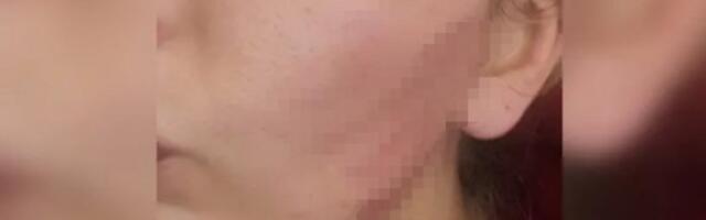 "NIJE IMAO PREBIJENE PARE, ŽIVELI SMO KAO PODSTRANARI!" Potresno svedočenje pretučene Ave Karabatić, KROZ SUZE SE SETILA SVEGA!