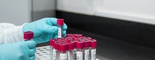 U poslednja 24 sata još 3.499 pozitivnih na koronavirus, preminulo 17 osoba