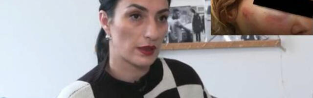 GODINU DANA MRŽNJE BLOKADERA, NISU POŠTEĐENA NI DECA Dečaka (13) zlostavljali, gađali petardama i terali da viče da je &quot;ćaci&quot;