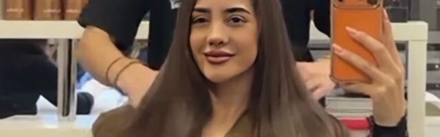 Anđela Đuričić pokazala novi nos: Skinula zavoje nakon operacije, ljudi u čudu zbog njenog novog izgleda