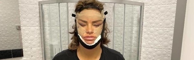 Zovu je veterankom plastičnih operacija i prepala je sve koji su videli fotke njene poslednje intervencije