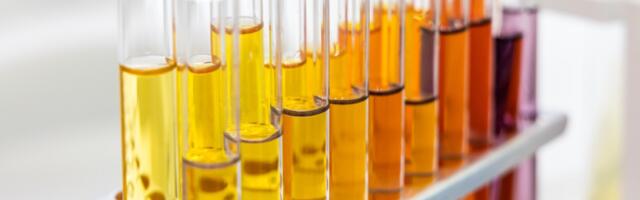 Šta boja urina govori o vašem zdravlju