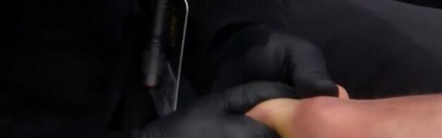 Nije za one sa slabim želucem! Nesreća za Cvjetićanina, protivnik mu dislocirao prst, vraćali ga u programu!