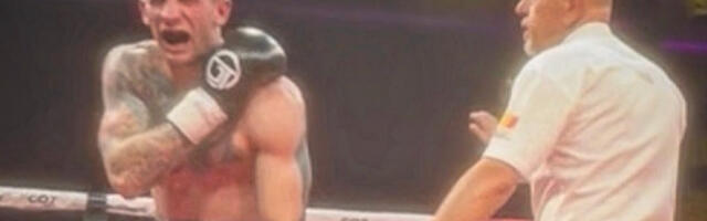 Skandal kakav se ne pamti - Pogledajte povredu srpskog boksera posle ugriza Albanca