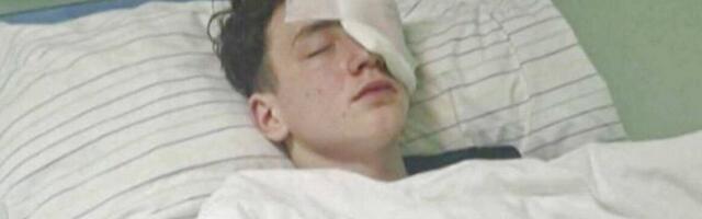 Martin (15) ostao bez oka i prstiju zbog petarde! "Nisam čuo ništa, onda su počeli da viču 'Nemaš palac'!