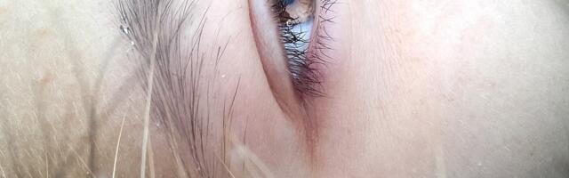 “Mušice” u vidnom polju moglu da budu znak ozbiljnog problema