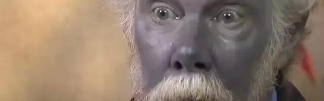 Čovek koji je poplaveo zbog suplemenata na bazi srebra