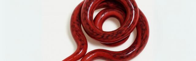 Jeziva dijagnoza: Muškarcu iz bubrega izašao crv dug 30 centimetara