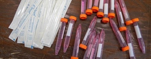 U RS 537 novih slučajeva korona virusa, preminulo osam osoba, u bolnicama oko 700 ljudi