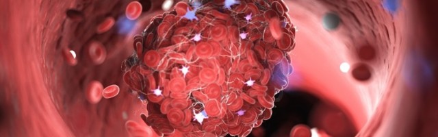 Zbog promene u krvi, simptomi korone traju mesecima