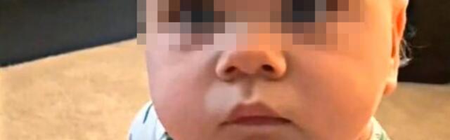 Moj sin sa 10 meseci ima dlake ispod pazuha i jak miris znoja: Ignorisali su me, a onda je stigla dijagnoza