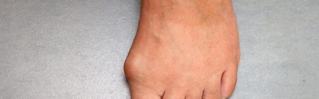 Da li vas često svrbi levi taban? Evo šta kaže verovanje, nesreća vam dolazi samo u jednom slučaju