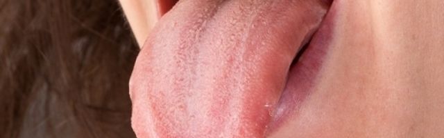 Zabeležen neobičan simptom korona virusa