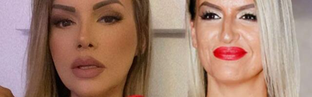 NEVEROVATNA TRANFORMACIJA ERMINE PAŠOVIĆ Bivša zadrugarka odavno ne liči na sebe, a ovo je spisak svih intervencija (FOTO)