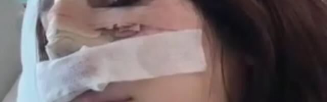 PRVA SLIKA NOVOG NOSA NINE ĐOGANI! Isplivao snimak Lunine sestre posle operacije!