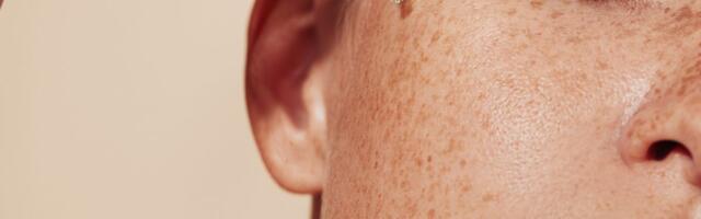 Da li "botoks u bočici" briše bore ili je još jedan mit sa društvenih mreža? Dermatolozi otkrivaju istinu