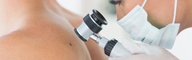 Dermatolog može doslovno videti nivo vašeg stresa: Ove stvari na licu su jasan znak da ste pod većim pritiskom