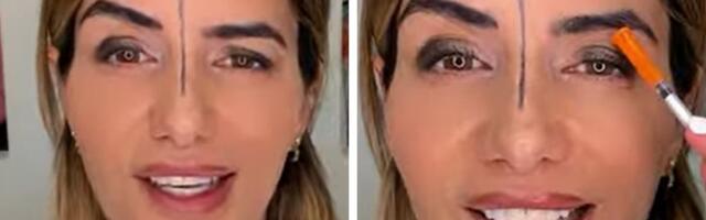 Doktorka ubrizgala botoks u JEDNU STRANU ČELA i pogledajte šta se dogodilo: Ovo je rezultat EKSPERIMENTA