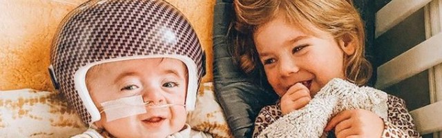Dečak sa kacigom koji inspiriše svet: Priča o bebi koja se rodila sa prelomima kostiju (FOTO)
