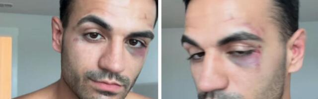 Žalio se da ga je "devojka" udarila jer joj nije spremio doručak: Ljudi skočili da ga brane, a onda je pokazao kako ona izgleda i šokirao sve