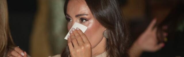 10.000 EVRA PLATILA NAJNOVIJU INTERVENCIJU NA LICU! Emina Jahović se u Turskoj podvrgla radikalnom zahvatu - OVAKO IZGLEDA NAKON OPERACIJE! (GALERIJA)