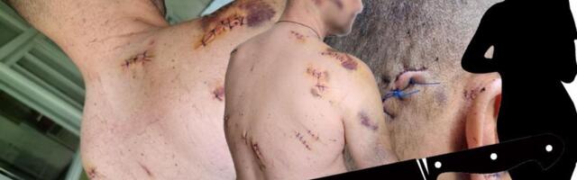 Da li postoji pravda za muškarce koji su žrtve nasilje? Viši sud u Jagodini osudio ženu koja je muža uspavala i izbola 17 puta