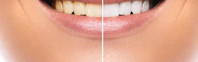 Ako do ove godine života imate svoje zube, doživećete stotu