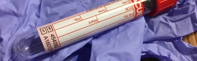REVOLUCIONARNO OTKRIĆE KOREANACA: Pronašli test koji istovremeno otkriva OVE DVE GADNE BOLESTI