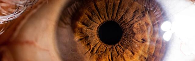 Suše vam se oči? To može biti ZNAK UPOZORENJA za Šegrenov sindrom