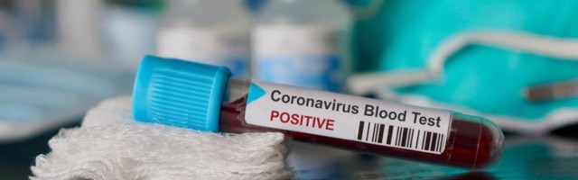 Zvanično 579 novih slučajeva koronavirusa, preminule tri osobe